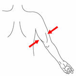  Triceps