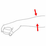  Lower arm
