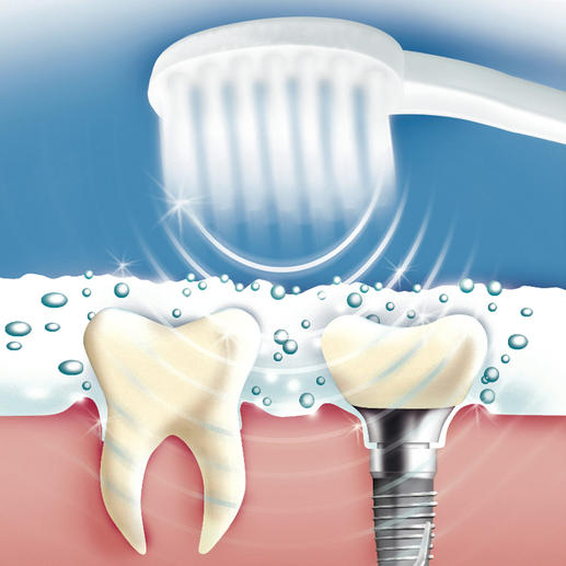 84 million air oscillations per minute lather the special Ultrasound Toothpaste into a micro-fine foam. When the bubbles implode, food debris, plaque, bacteria, etc. and stains are gently removed. (Unfortunately, this does not work with ‘normal’ toothpaste.)