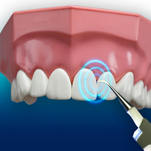 With 3,000 vibrations/min you can reach the smallest interdental spaces.